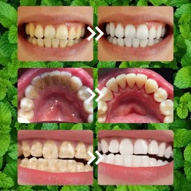 2pcs Pasta Dientes Blanqueadora Con Probióticos FolvirexPolvo blanqueador dental,Blanqueador dental morado,Eliminador de sarro,Higiene bucal menta,   
