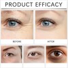 Castor and Frankincense Rollerball Eye Cream for Dark Circles, Puffy