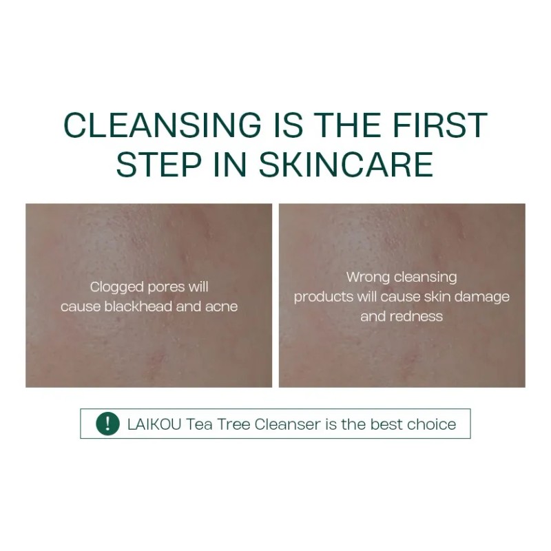 Crema Limpiadora Facial Laikou Para Eliminar Granos