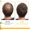 Laaceite Capilar Con Biotina Eelhoe Para El Cuidado Profundo