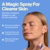 Magic Molecule Hypochlorous Acid Spray for Breakout-Prone Skin, Eczema &