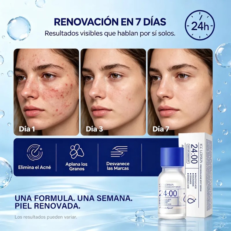 Suero Acido Salicílico 2% Con Niacinamida Antiacné 2 Pzs