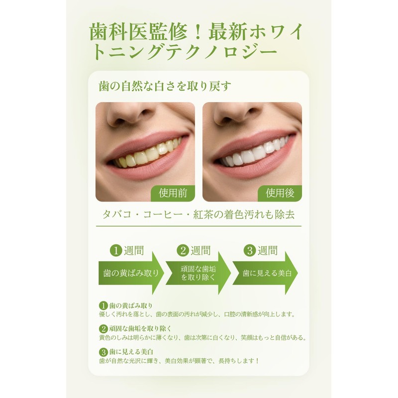 Whitening Sheet, 14 Days Worth, Gently Removes Stains, Tones Teeth,