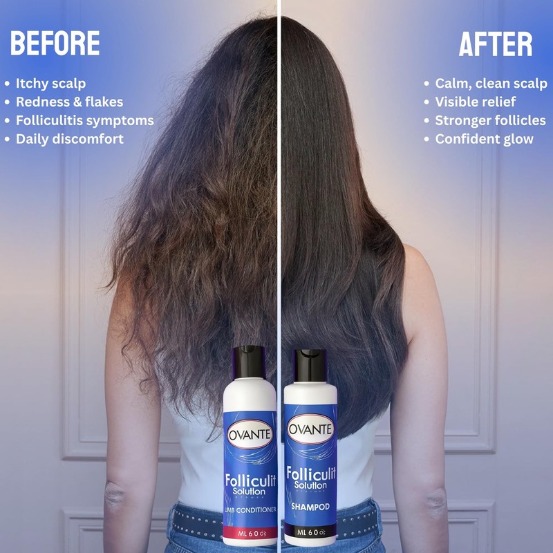 OVANTE Folliculit Solution Shampoo & Conditioner Set - Ingrown Hair