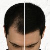 Kit Crecimiento Capilar + Antiojeras | Anti Caída + Bolsas