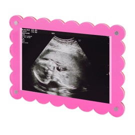 Magnetic Scalloped Acrylic Picture Frame, 7.1x5.1 Inch Baby Scan Photo Frames Pregnancy Announcement Photo Frame Keepsake for Gender Reveal Expectant Parents Gift (Pink)