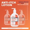 Rugby Loción antipicazón - Alcanfor 0.5% - Mentol 0.5% -
