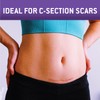 Care Science C Section Recovery Silicone Scar Sheets 1.5in x