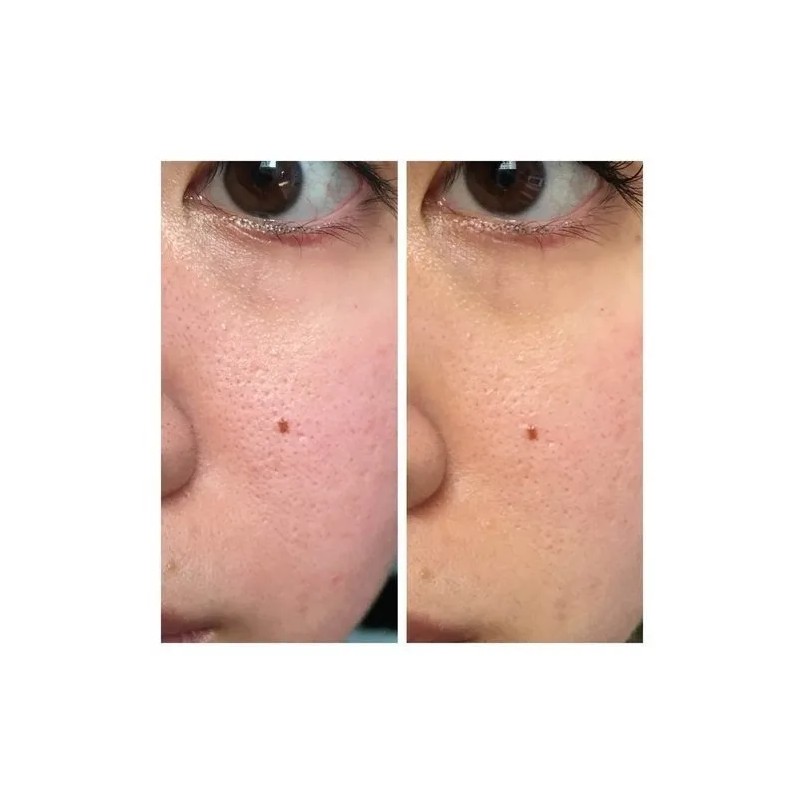 Sérum Blemish y Age Defense SkinCeuticals día noche para piel