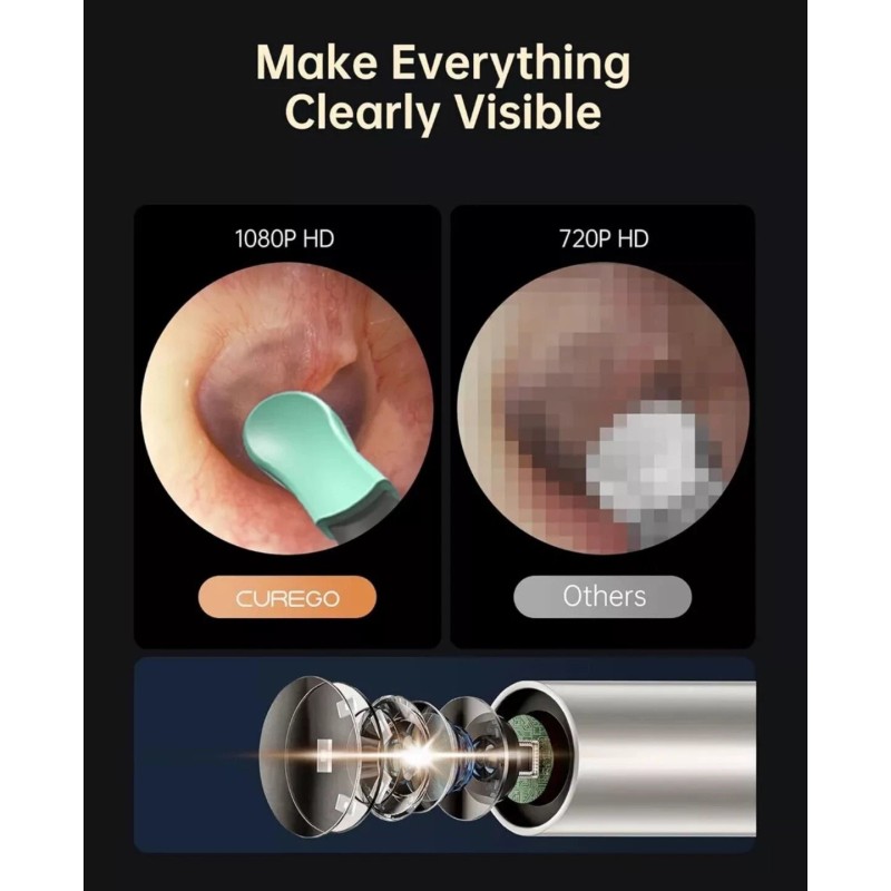 Curego X17 Pro Max Ear Wax Removal Camera Endoscope, All