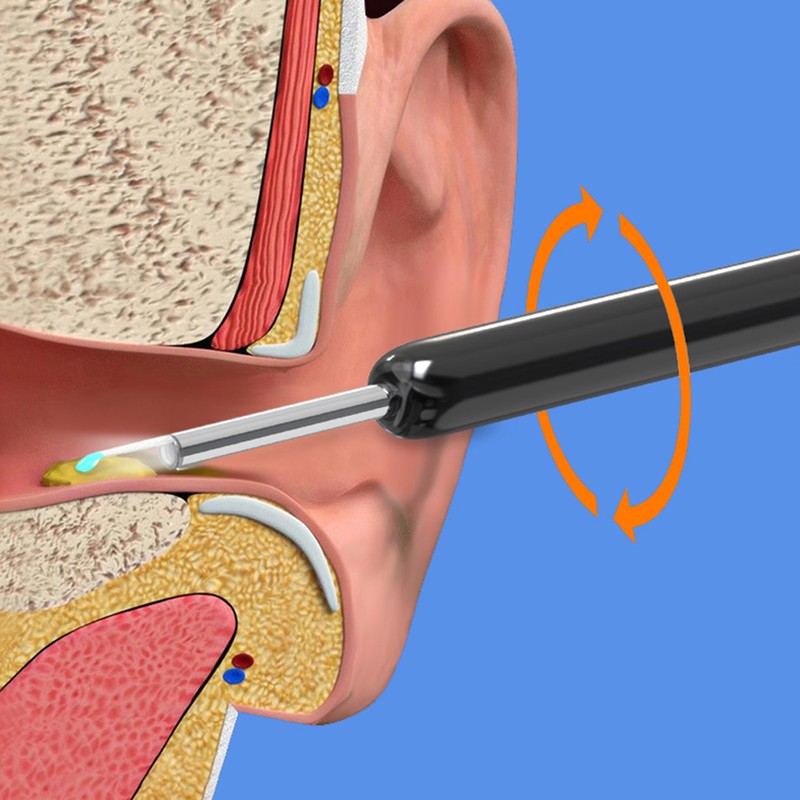 Rechargeable Ear Cleaner Wireless Visual Ear Wax Remover Ear Picking