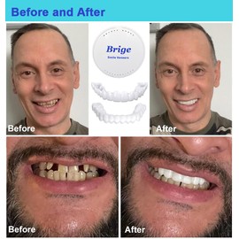 Denture Smile Teeth Customizable Temporary Perfect Fake Teeth Molds Braces for Snap in Instant &Confidence Smile