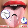 Stainless Steel Tongue Cleaner, Set of 2 for Bad Breath