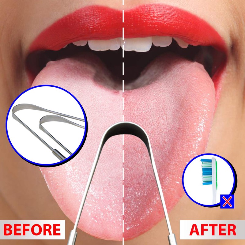Stainless Steel Tongue Cleaner, Set of 2 for Bad Breath