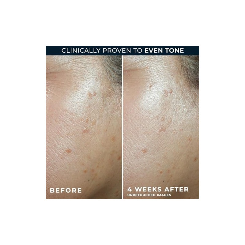 Hidratante Diario Roc Multi Correxion