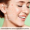 Acne Pimple Patch for Targeting Zits and Blemishes on the