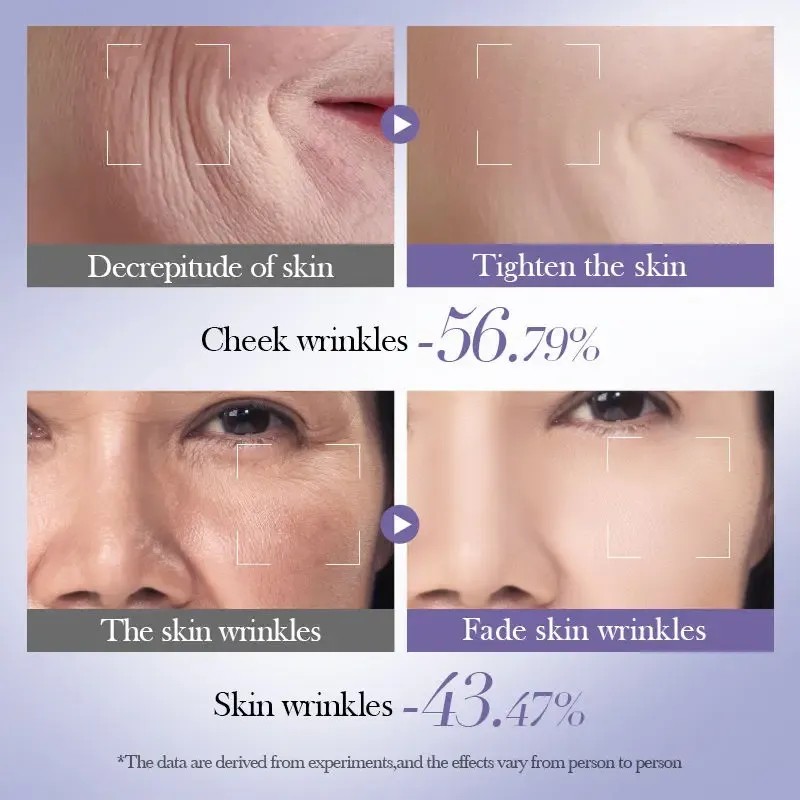Kit Facial Retinol Antienvejecimiento Vitamina A Bioaqua 6 En 1