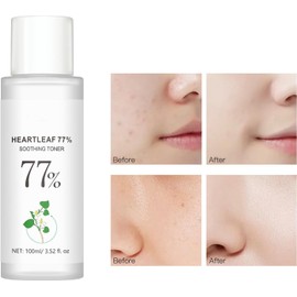 Heart Leaf 77 Toner -Täglicher Gesichtstoner - Haut Erfrischende Essenz für ebenmäßigen Teint, Feuchtigkeit für trockene und raue Haut - Feuchtigkeitsspendende und beruhigende Essenz