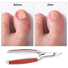 Toenail Clipper for Thick or Ingrown Nails,Heavy Duty Nail Clipper Cutter for Fingernails Toenails,Podiatrist Toenail Nipper Grooming Tool,Sharp Blade Safety Knock,Wooden Handle