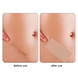 Rose Romee Tattoo Cover up Patch 8 Pcs (Pack of 1), Waterproof Sweatproof Sticker Patch, tattoo cover up waterproof, Ultra Thin Patch for Tattoo Scar and Birthmarks Tattoo Cover Up Tape for Light Skin Tone