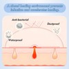 Rayyl Silicone Scar Sheets (1.6" x 60" Roll - 1.5M)