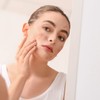LOVVES Game Over Pimple Treatment Serum, High Natural Cosmetics, Anti-Acne,
