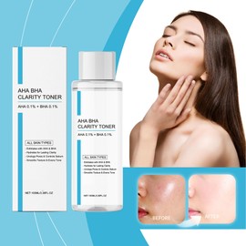 Beruhigender Toner zur Ölkontrolle – 100 ml peelt, minimiert Poren, spendet Feuchtigkeit und hellt die Haut auf, ist es für alle Hauttypen geeignet