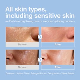 Niacinamide Hyaluronic Acid Booster Serum by Cosyuree – 100,000ppm Brightening & Hydrating Formula, Even Toning, Radiance-Boosting for Plumper, Smoother Skin, Fragrance-Free, 30ml (1.01 fl oz)