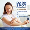 Dark Spot Corrector for Face and Body: For Age Spots,
