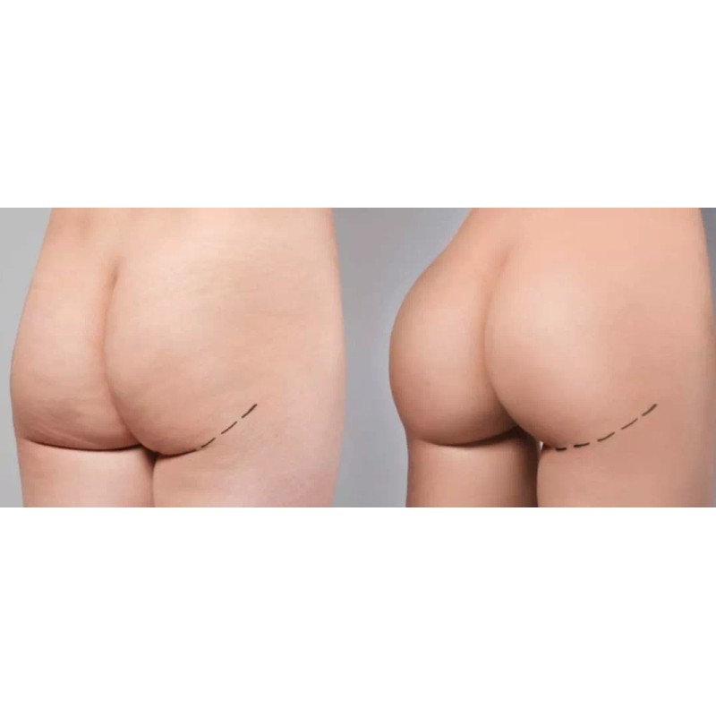 A&R Gel Fenogreco Kit X 2 Glúteos,busto,músculos,hombre ,mujer