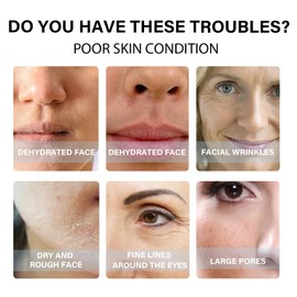 Hydrolyzed Collagen Protein Line 20 Pieces Protein Thread Lifting Set, Absorbable Collagen Thread, Instalift Protein Thread Lifting Set, Nano Gold Essence, Lift Skin Tightening and Reducing Fine Lines