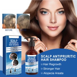 Mnozreo Hair Growth Shampoo, Anti-Hair Loss, 100 ml, 1 Piece, Anti-Hair Loss Repairing Care Shampoo for Men and Women