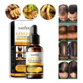 Suero Extracto De Jengibre Crecimiento Del Cabello 30ml