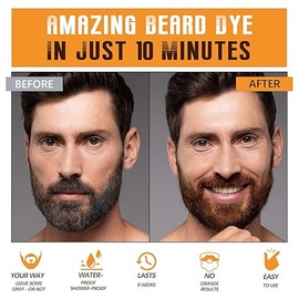 Mens Beard & Mustache Dye Shampoo, Instant 100% Grey Hair Coverage, 3 in 1 Brown Beard Color Shampoo for Men Facial Hair, Easy to Use & Dermatologist Tested, 200ML