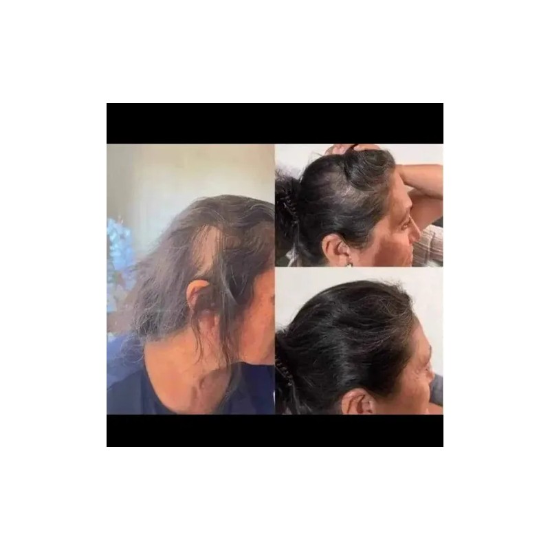 Shampoo Reviving Farmasi /con Ajo , Capixyl Y Trichogen