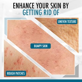 GLY MIRACLE Moisturizing Body Lotion Non-Greasy Skin Humectant for Extremely Dry Skin, Hands, Body, and Feet, Light, Fresh Scent with Pure Glycerin for Nourishing Hydration 16 oz Jar