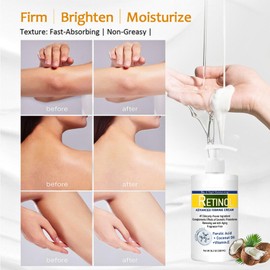 300ml Retinol Body Lotion, Advanced Retinol Cream, Large-capacity Retinol Firming Body Cream with Cocount Oil and Vitamin E, Remove Dark Spots, Moisturizing Body Lotion for Dry Skin, Smooth Body Skin