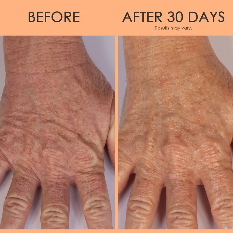 Crépe Erase Advanced – Anti Aging Hand Repair Treatment with