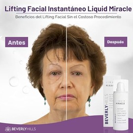 Beverly Hills Tratamiento de suero de ojos antienvejecimiento instantáneo para ojeras, ojos hinchados, arrugas, bolsas debajo de los ojos, líneas fina