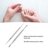10pcs 13mm Ingrown Toenail Corrector Stainless Steel Ingrown Toe Wire