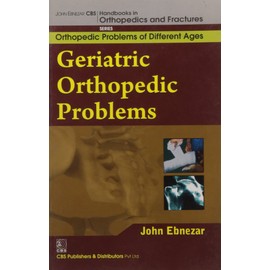 John Ebnezar CBS Handbooks in Orthopedics and Factures: Orthopedic Problems of Different Ages : Geriatric Orthopedic Problems