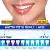 SSKHE Pack of 28 Teeth Whitening Bands, 9D Teeth Whitening