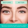 Patchology Restoring Night Eye Gels - Under Eye Patches For