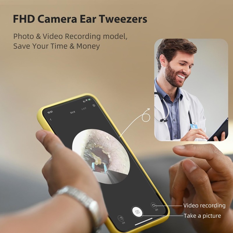 Bebird Pro Note5 Ear Picker with Camera Tweezers, Wireless Wax