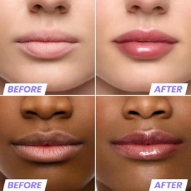 Wonderskin Lip Oil Rehab Serum - Tinted Lip Oil, Hydrating Lip Serum | Hydrating tinted or clear lip oil nourishes dry lips with a glossy deep red fin