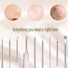 5 Piece Blackhead Remover Set, Blackhead Remover Made of High-Quality