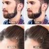 Shzhdikun Glwz 0.5mm 1200 Microagujas Dermaroller Hair Roller Barba Cabello