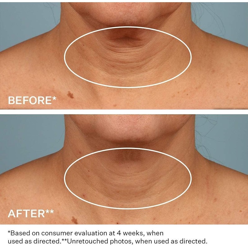 StriVectin, Crema para Cuello para apretar y levantar, 30 ml