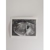 Prank 2D Customized Fake Ultrasound Single Photo ONLY NO Gender