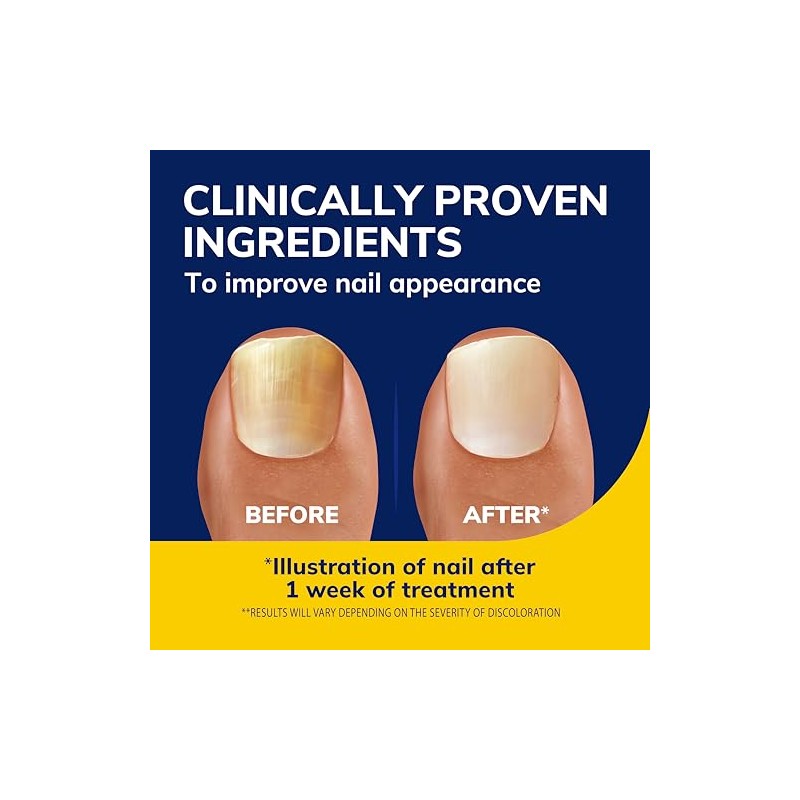 Dr. Scholl's Fungal Nail Revitalizer Liquid, 10ml
